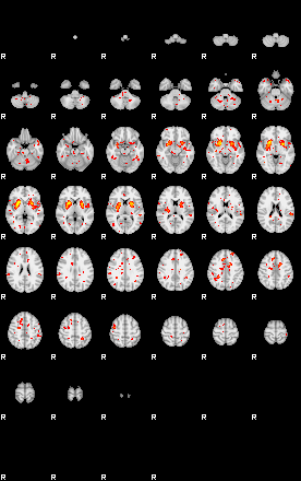 Patient:55;component:39