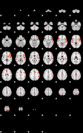 Patient:55;component:41