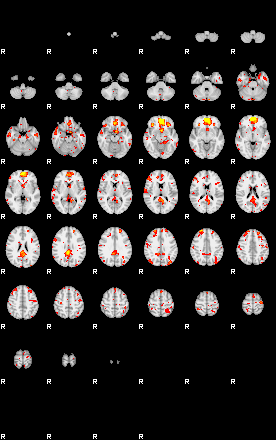 Patient:55;component:49