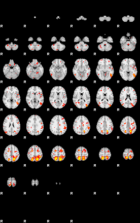 Patient:55;component:55