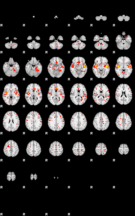 Patient:55;component:58