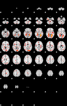 Patient:55;component:69