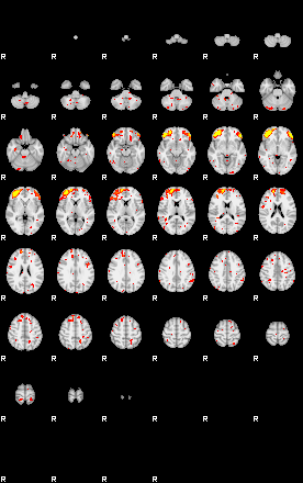 Patient:55;component:7