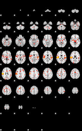 Patient:55;component:71