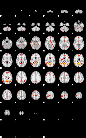 Patient:56;component:100