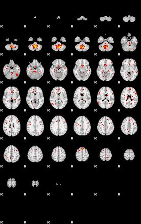 Patient:56;component:14