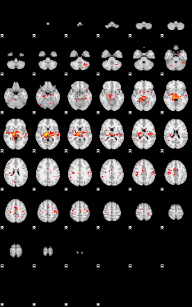 Patient:56;component:2