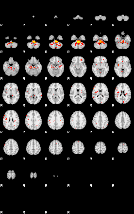 Patient:56;component:32