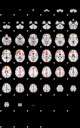 Patient:56;component:48