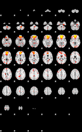 Patient:56;component:49