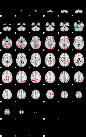 Patient:57;component:111