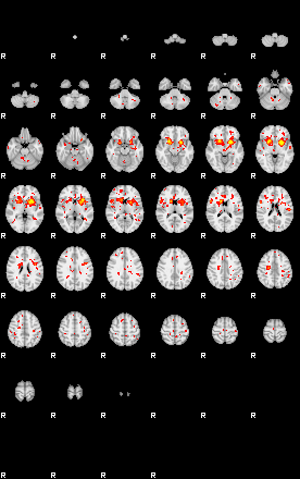 Patient:57;component:112