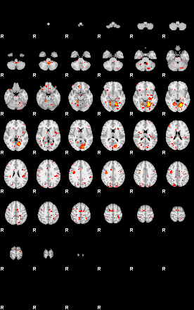 Patient:57;component:136