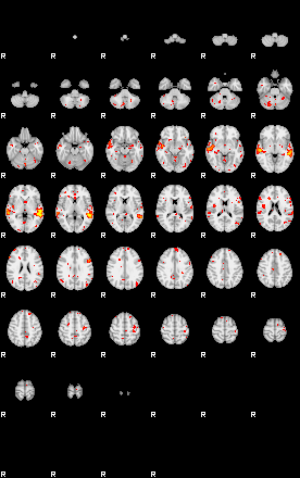 Patient:57;component:140