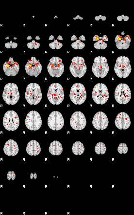 Patient:57;component:160