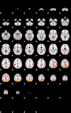 Patient:57;component:173