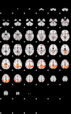 Patient:57;component:180