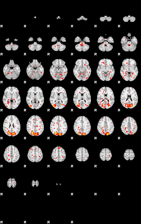 Patient:57;component:182