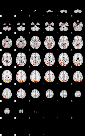 Patient:57;component:184