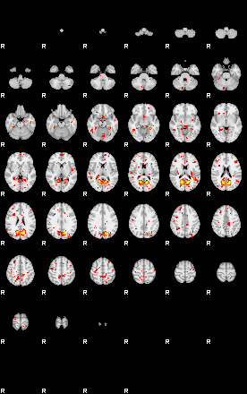 Patient:57;component:29