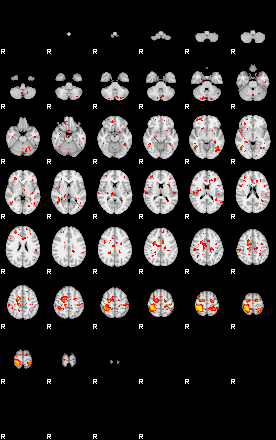 Patient:57;component:34