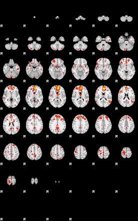 Patient:57;component:44