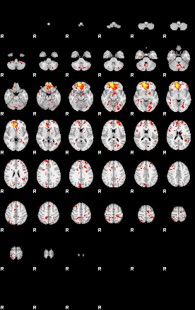 Patient:57;component:48