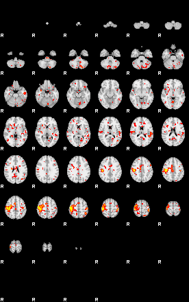 Patient:57;component:51