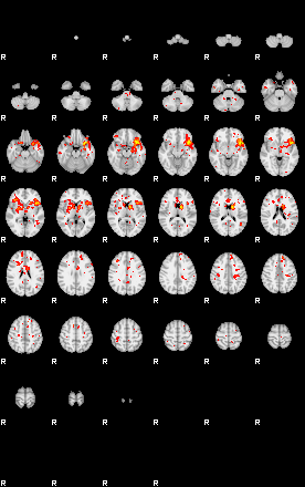 Patient:57;component:52