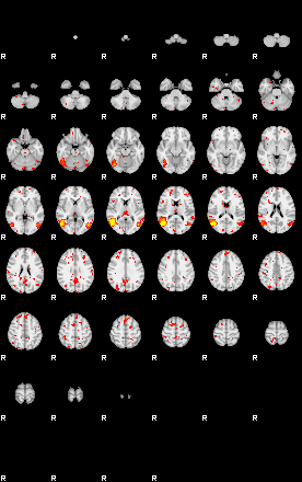 Patient:58;component:100