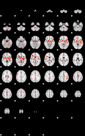 Patient:58;component:129