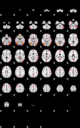 Patient:58;component:143