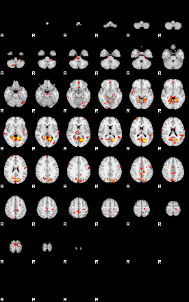 Patient:58;component:161