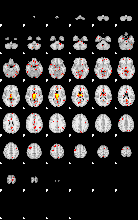 Patient:58;component:167