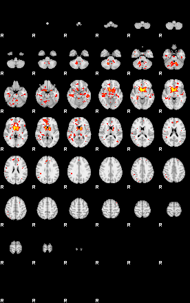 Patient:58;component:169