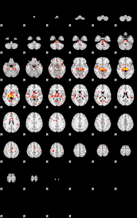 Patient:58;component:2