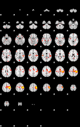 Patient:58;component:21