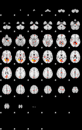 Patient:58;component:29