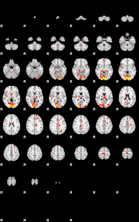 Patient:58;component:30