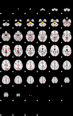 Patient:58;component:32