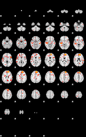 Patient:58;component:44