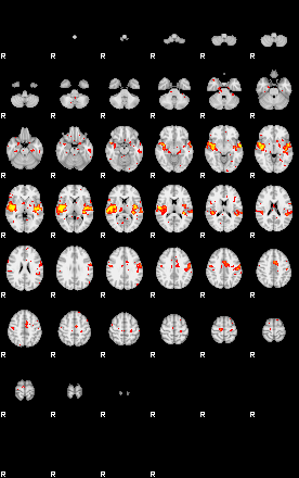 Patient:58;component:58