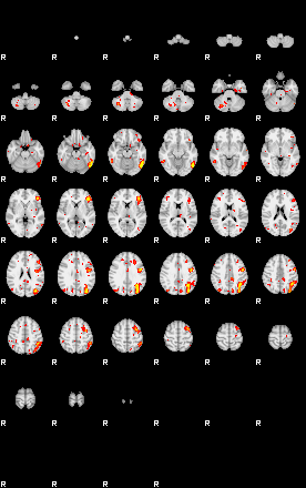 Patient:59;component:130