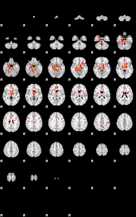 Patient:59;component:160