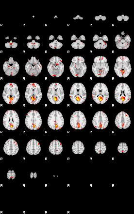 Patient:59;component:5