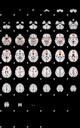 Patient:59;component:52