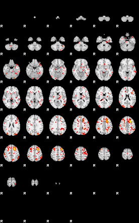 Patient:5;component:23