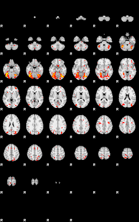 Patient:60;component:122