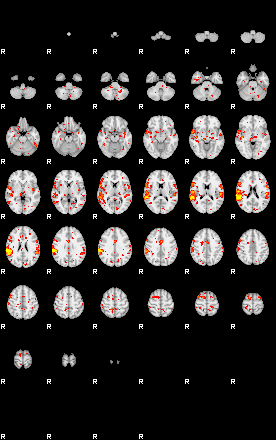 Patient:60;component:150