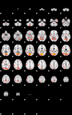 Patient:60;component:53